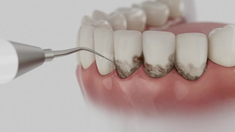 Reliable Emergency Dentist contractor in Dillon, MT by Smile Center Dentistry
